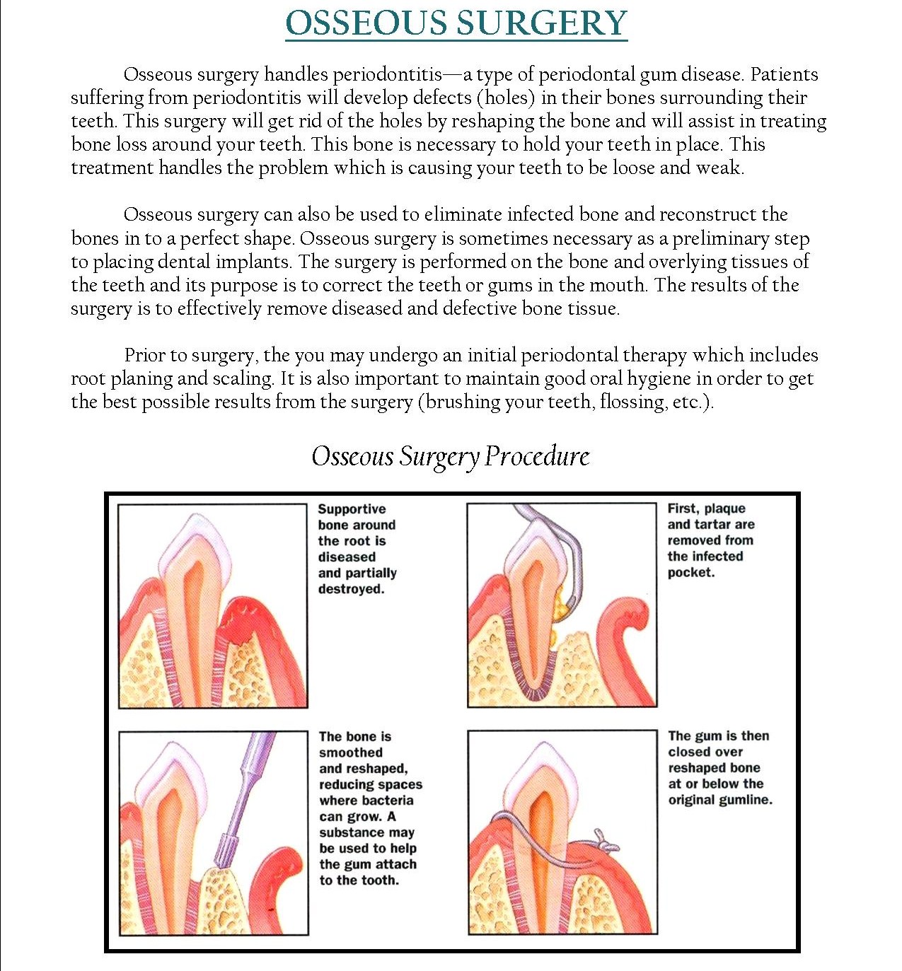 Osseous Surgery Dr Bernard Fialkoff