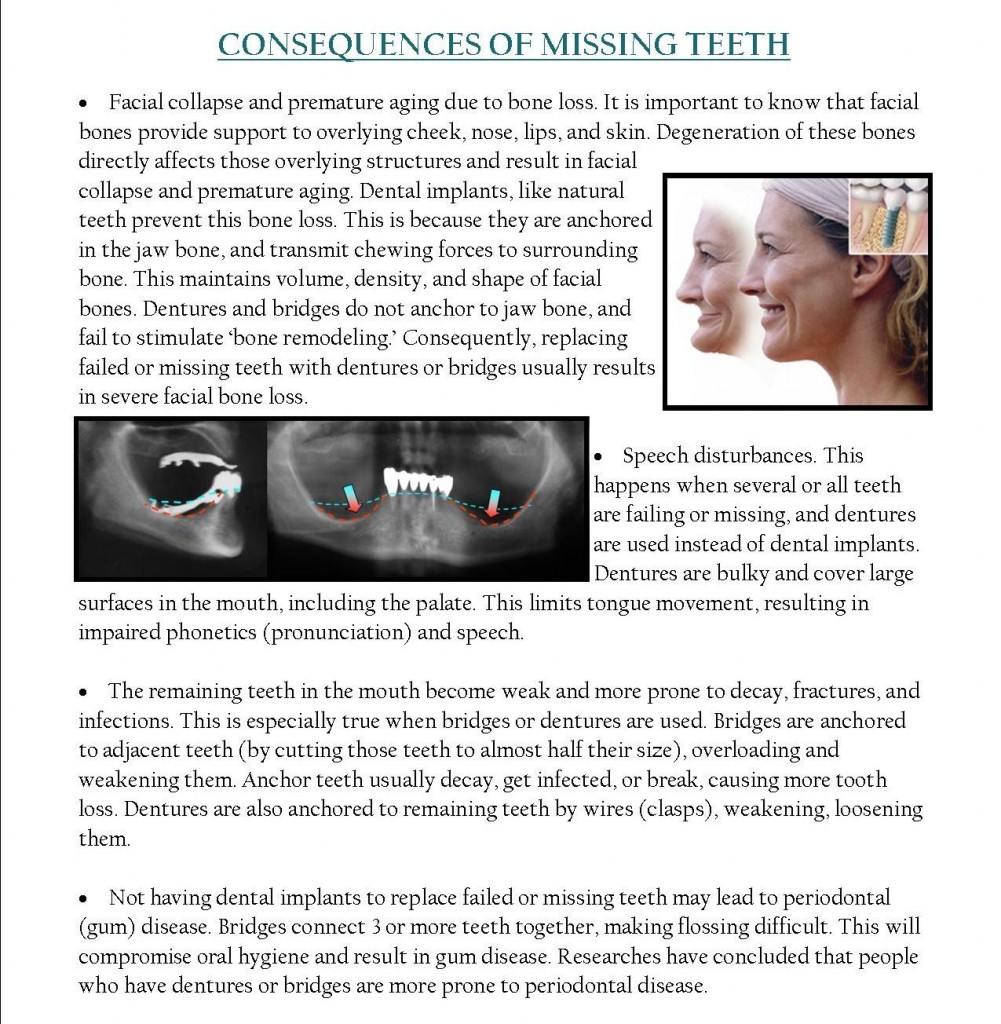 Consequences Of Missing Teeth