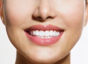 Girl Smiling - Bayside Dentist