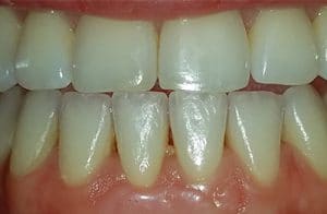 Periodontal Gum Treatment services