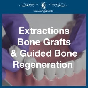 Extraction Bone Graft Guided Bone Regeneration featured image
