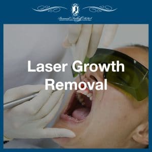 Laser Growth Removal In Bayside