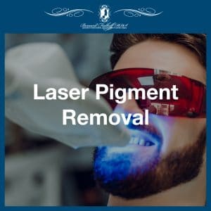 Laser Pigment Removal featured image