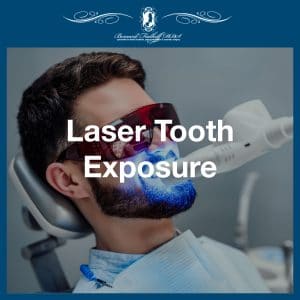 Laser Tooth Exposure featured image