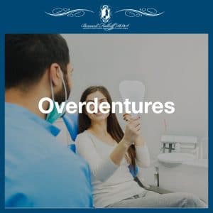 Overdentures featured image