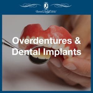 Overdentures And Dental Implants featured image