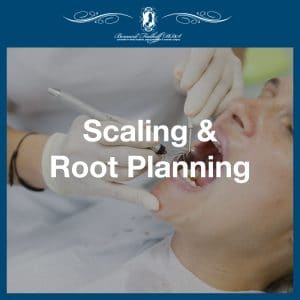 Scaling and Root Planning