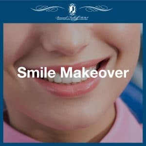 Smile Makeover featured image