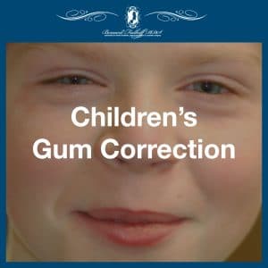 Children Gum Correction featuredd image